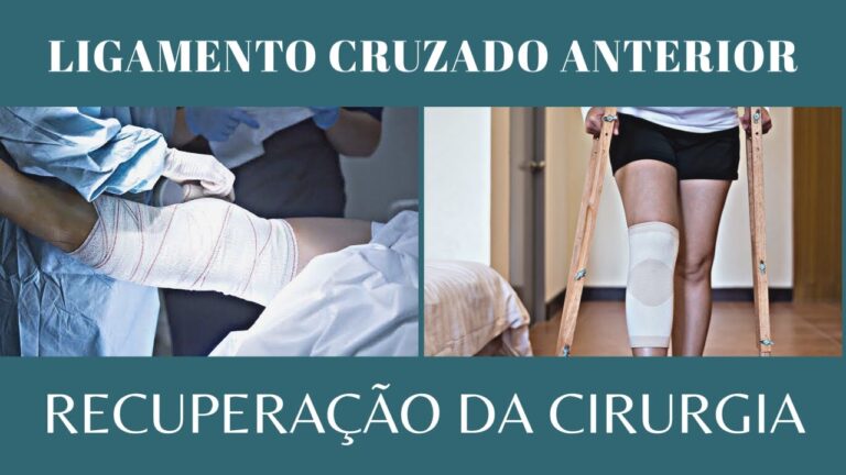 recupera-o-eficiente-da-cirurgia-de-joelho-menisco-e-ligamento