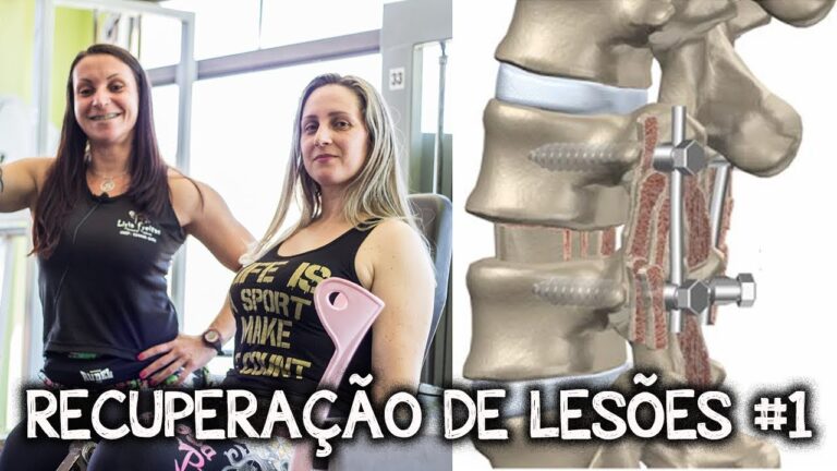 Tempo de Recuperação da Lesão Lombar: O Que Esperar