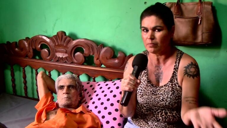 Entendendo a Edema Virilha: Causas e Tratamentos