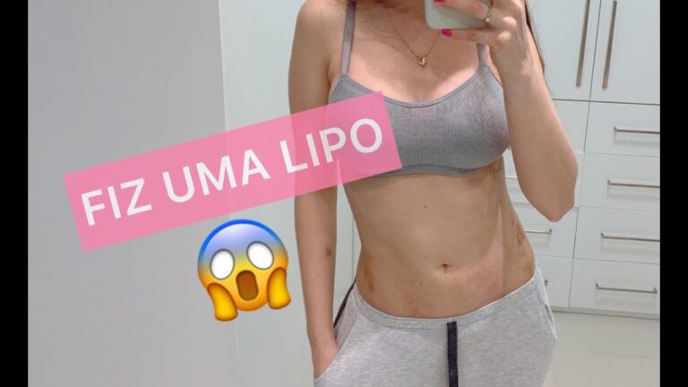 Transformações Impressionantes: Fotos Antes e Depois da Lipoaspiração