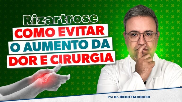 Tratamento Eficaz para Rizartrose: Dicas e Estratégias