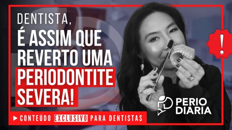 Como Curar a Periodontite de Forma Eficaz