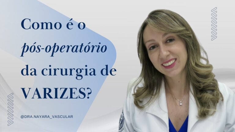 Recuperação Eficiente Após Cirurgia das Varizes