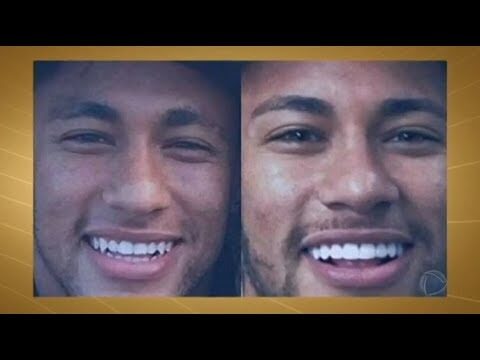 Pelicula Dentaria: O Que Você Precisa Saber sobre a Saúde Bucal