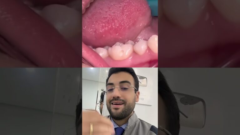 Preto entre os Dentes: Causas e Soluções Eficazes
