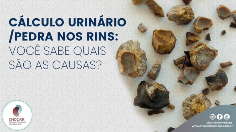 Cálculo Renal: Importância dos Exames Laboratoriais