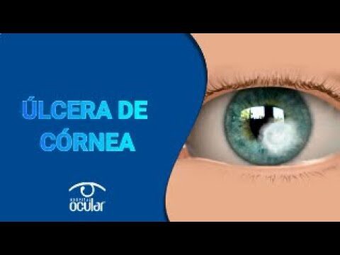 Entendendo a Úlcera de Córnea: Causas e Tratamentos