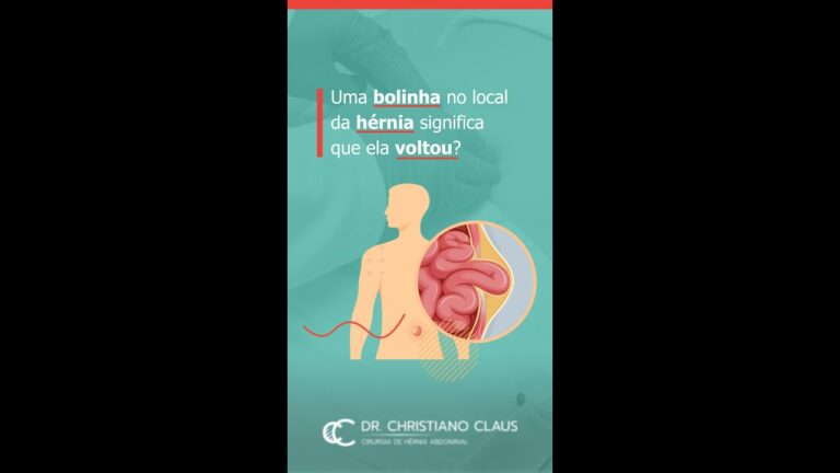 Como Identificar a Recorrência da Hérnia Umbilical
