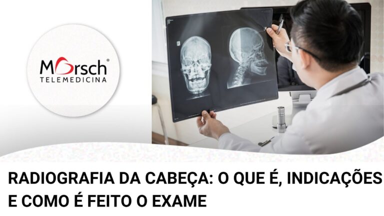 Raio X da Cabeça: Detecção de Tumores Eficiente