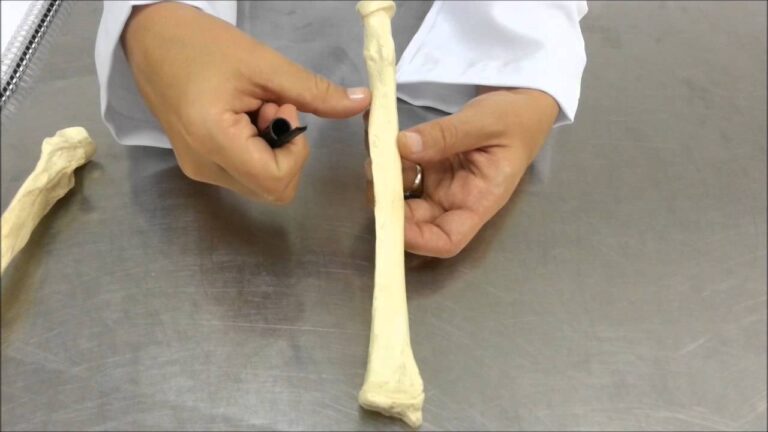 Explorando a Tuberosidade do Rádio: Funções e Importância