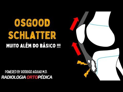 Importância da Tuberosidade Anterior da Tíbia na Biomecânica do Joelho