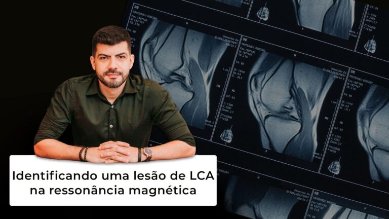 Ressonância Magnética do Joelho: Diagnóstico de Ligamento Rompido