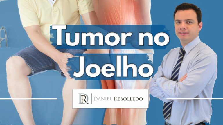 Cisto no Joelho: Riscos de Câncer e O Que Saber