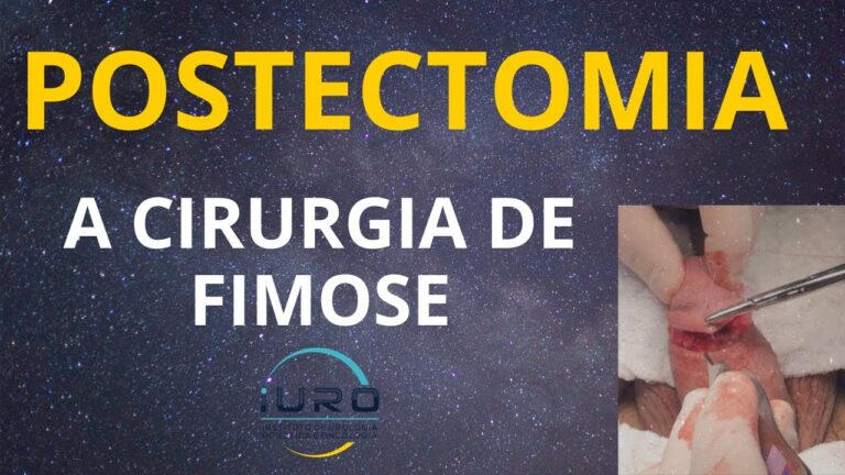 Cirurgia de Parafimose: Abordagem e Tratamento Eficaz
