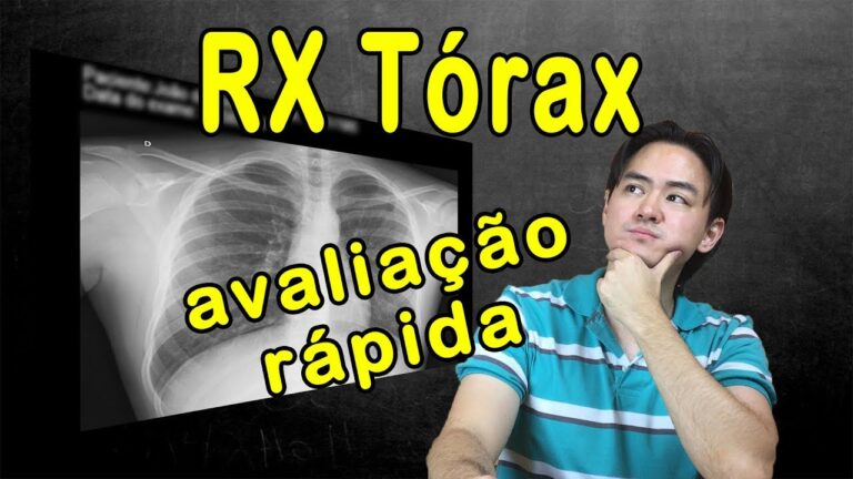 Custo do Raio X do Pulmão: O Que Você Precisa Saber