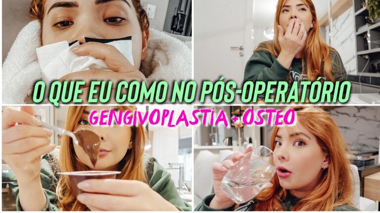 Cuidados Essenciais no P&oacute;s-Operat&oacute;rio de Gengivoplastia
