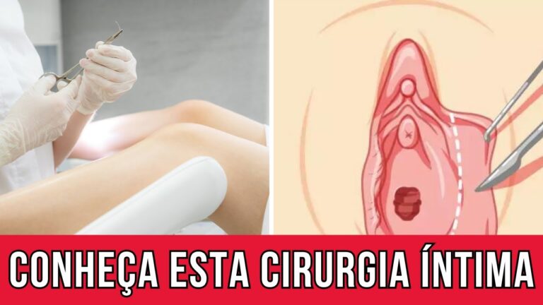 Reduzindo os Pequenos Lábios de Forma Natural