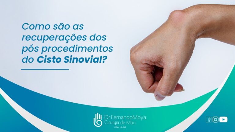 Repouso Necessário Após Cirurgia de Cisto: Quantos Dias?