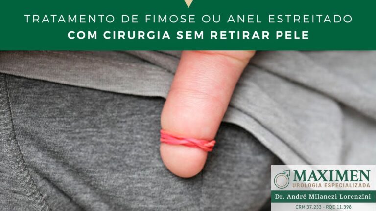 Cirurgia Fimose com Anel: Benefícios e Considerações