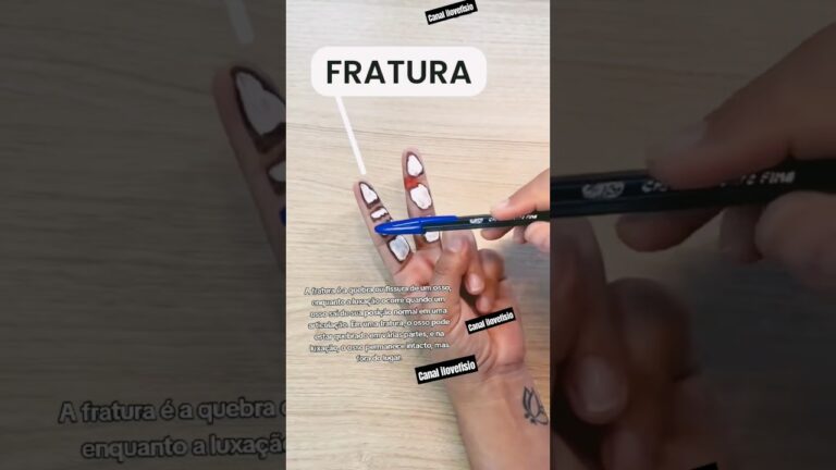 Fissura no Dedo: Causas, Sintomas e Tratamentos Eficazes