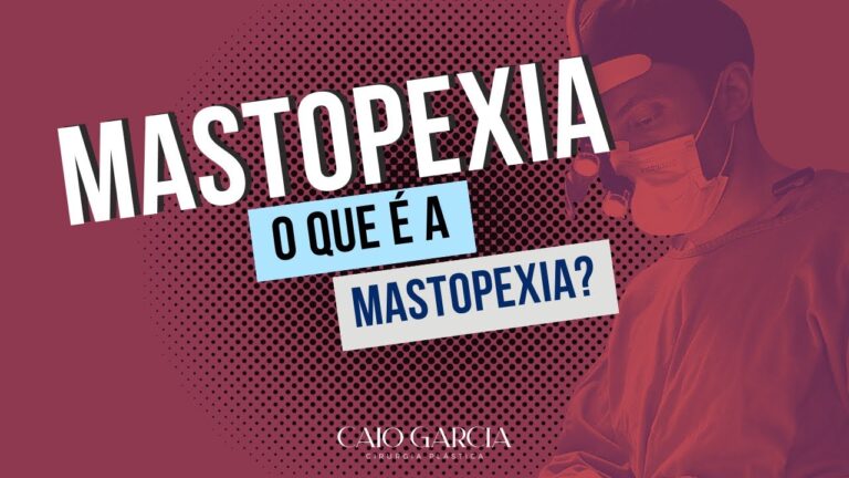 Entendendo a Mastopexia: O Que É e Como Funciona