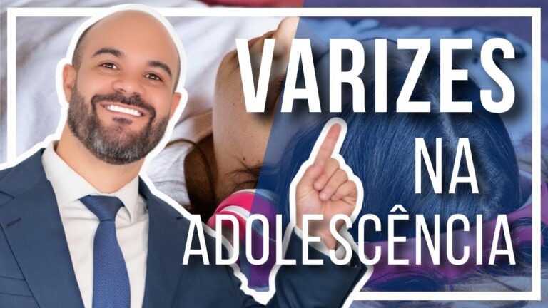 Varizes em Jovens: Causas e Prevenção