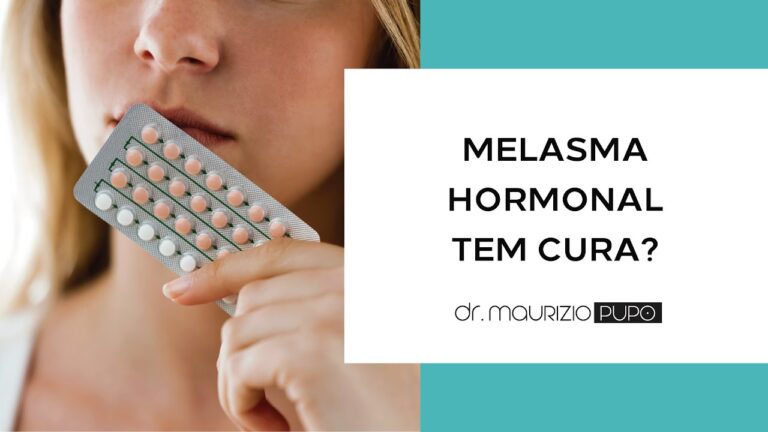 Melasma Hormonal: Existe Cura?