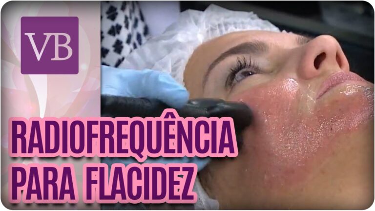 Transforma&ccedil;&otilde;es da Radiofrequ&ecirc;ncia Facial: Antes e Depois