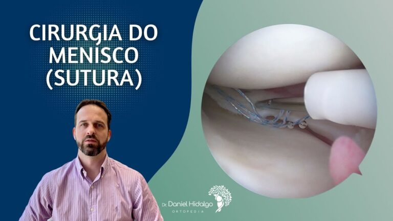 Reparo vs. Sutura de Menisco: Qual a Melhor Opção?
