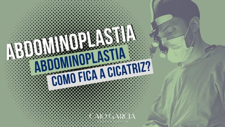 Cicatriz da Abdominoplastia: O que Esperar e Como Cuidar