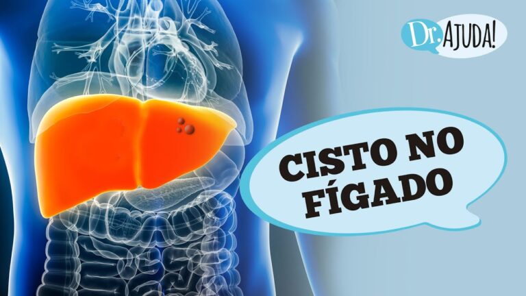 Cisto no F&iacute;gado: Riscos e Cuidados Essenciais