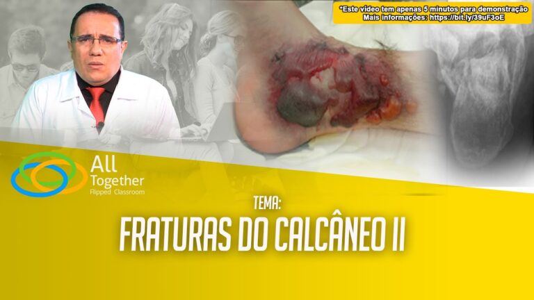 Avanços na Cirurgia de Calcâneo: Técnicas e Recuperação