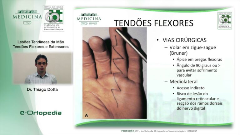 Importância e Cuidados com os Tendões da Mão