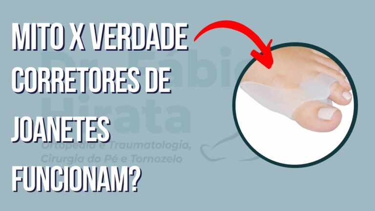 Soluções Eficazes: Protetores para Joanete