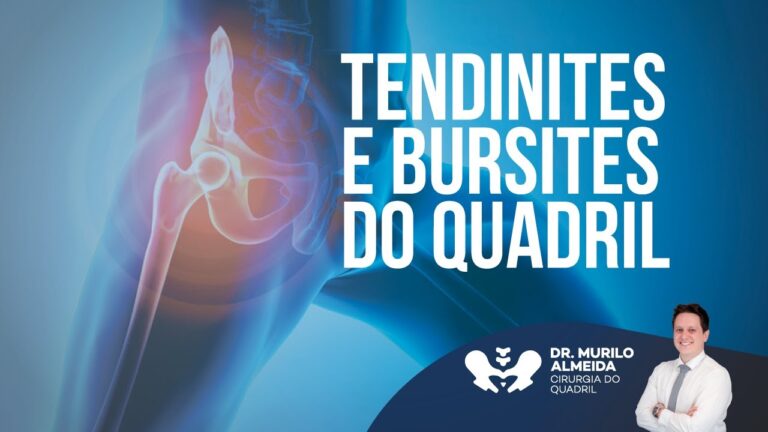 Tratamento Eficaz para Tendinite no Quadril