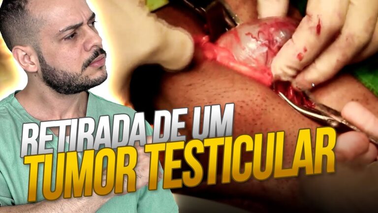 Retirada de Testículo: Entenda a Cirurgia e Seus Aspectos