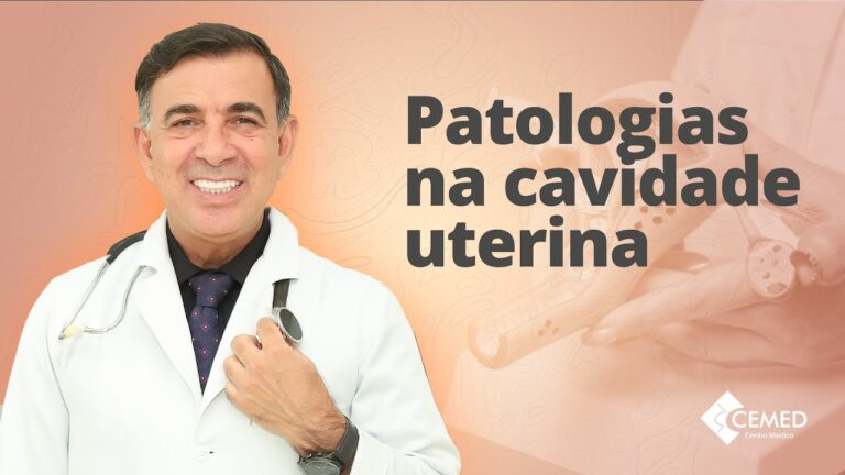 Liquido na Cavidade Endometrial: Causas e Implica&ccedil;&otilde;es