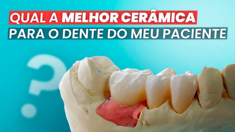 Cerâmica para Dentes: Estética e Durabilidade em Odontologia