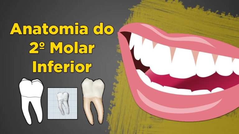 Localização do Dente 47: Tudo o que Você Precisa Saber