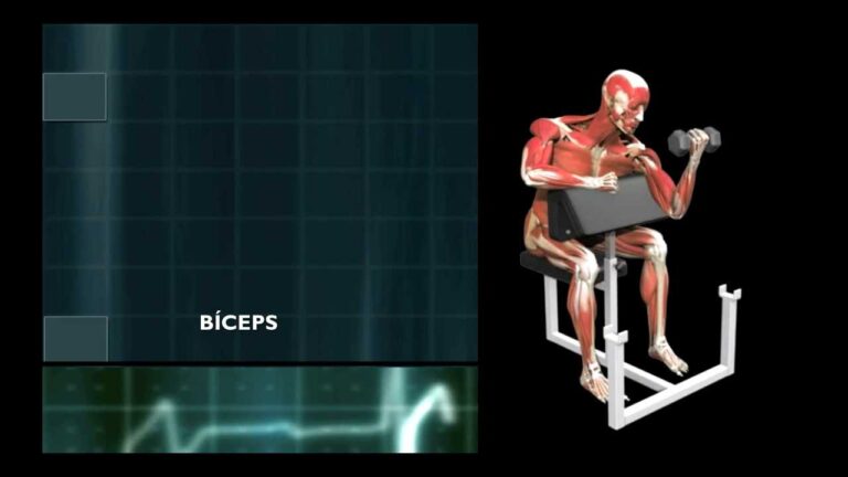 Entendendo a Artrite Acromioclavicular: Causas e Tratamentos