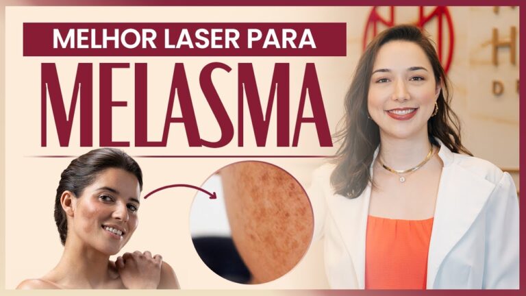 Laserterapia no Tratamento do Melasma