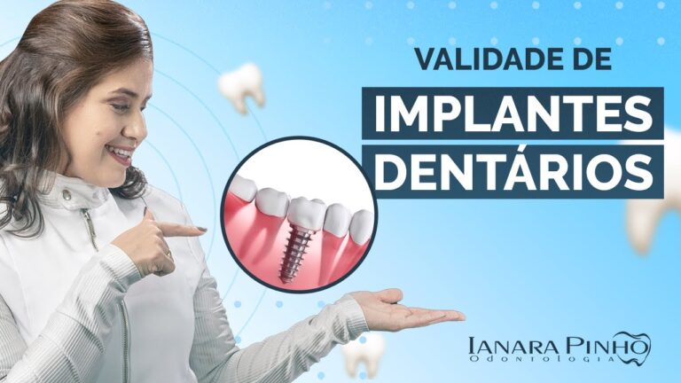Dura&ccedil;&atilde;o do Piv&ocirc; Dent&aacute;rio: O Que Voc&ecirc; Precisa Saber