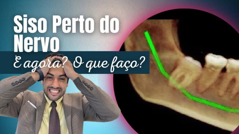 Siso no Nervo: Causas, Sintomas e Tratamentos